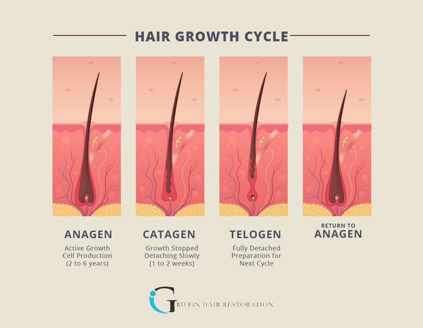 Dr. Thomas Griffin explains the three phases of the hair growth cycle.